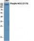 NOS3 (phospho Ser1177) Polyclonal Antibody