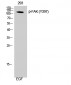 FAK (phospho Tyr397) Polyclonal Antibody