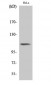 Integrin β3 (phospho Tyr785) Polyclonal Antibody