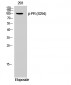 PR (phospho Ser294) Polyclonal Antibody