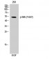 Brk (phospho Tyr447) Polyclonal Antibody