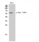 Chk2 (phospho Thr383) Polyclonal Antibody
