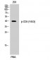 CD5 (phospho Tyr453) Polyclonal Antibody