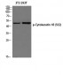 Cytokeratin 18 (phospho Ser52) Polyclonal Antibody