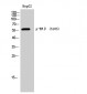 ERβ (phospho Ser105) Polyclonal Antibody