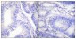 Shc (phospho Tyr427) Polyclonal Antibody