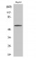 Smad2 (phospho Ser467) Polyclonal Antibody