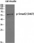 Smad2 (phospho Ser467) Polyclonal Antibody