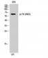 TH (phospho Ser62) Polyclonal Antibody