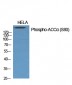 ACCα (phospho Ser80) Polyclonal Antibody