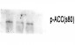 ACCα (phospho Ser80) Polyclonal Antibody