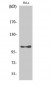 eEF2K (phospho Ser366) Polyclonal Antibody