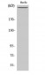 Filamin 1 (phospho Ser2152) Polyclonal Antibody