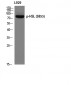 HSL (phospho Ser855) Polyclonal Antibody