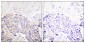 PLC γ1 (phospho Tyr771) Polyclonal Antibody