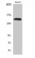 PLC γ2 (phospho Tyr753) Polyclonal Antibody