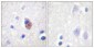 PYK2 (phospho Tyr881) Polyclonal Antibody