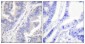 Syk (phospho Tyr348) Polyclonal Antibody