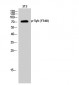 Syk (phospho Tyr348) Polyclonal Antibody