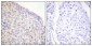 Syk (phospho Tyr525) Polyclonal Antibody