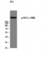 ACCα (phospho Ser80) Polyclonal Antibody
