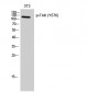 FAK (phospho Tyr576) Polyclonal Antibody