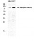 GR (phospho Ser226) Polyclonal Antibody
