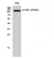 HSL (phospho Ser552) Polyclonal Antibody
