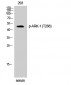 ARK-1 (phospho Thr288) Polyclonal Antibody