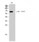 ERα (phospho Tyr537) Polyclonal Antibody