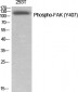 FAK (phospho Tyr407) Polyclonal Antibody