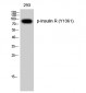 Insulin R (phospho Tyr1361) Polyclonal Antibody
