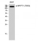 MYPT1 (phospho Thr853) Polyclonal Antibody