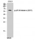 p70 S6 kinase α (phospho Ser371) Polyclonal Antibody