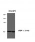 PEA-15 (phospho Ser116) Polyclonal Antibody