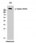 Tuberin (phospho Ser939) Polyclonal Antibody