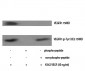 Flt-1 (phospho Tyr1333) Polyclonal Antibody