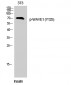 WAVE1 (phospho Tyr125) Polyclonal Antibody