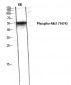 Akt1 (phospho Tyr474) Polyclonal Antibody