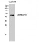 BLNK (phospho Tyr96) Polyclonal Antibody