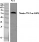 PFK-2 car (phospho Ser483) Polyclonal Antibody