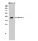 p38 (phospho Tyr323) Polyclonal Antibody