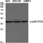 p38 (phospho Tyr323) Polyclonal Antibody