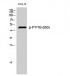 PTP1B (phospho Ser50) Polyclonal Antibody