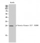 Casein Kinase IIβ (phospho Ser209) Polyclonal Antibody