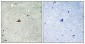 FAK (phospho Tyr397) Polyclonal Antibody