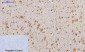 FAK (phospho Tyr397) Polyclonal Antibody