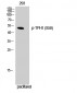 TPH1 (phospho Ser58) Polyclonal Antibody