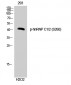 hnRNP C1/2 (phospho Ser260) Polyclonal Antibody