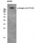 Integrin β4 (phospho Tyr1510) Polyclonal Antibody